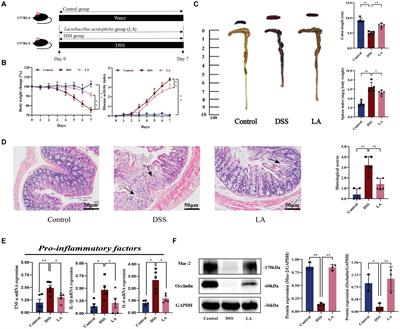 Lactobacillus acidophilus and its metabolite ursodeoxycholic acid ameliorate ulcerative colitis by promoting Treg differentiation and inhibiting M1 macrophage polarization